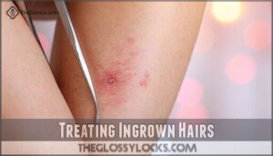 treating ingrown hairs