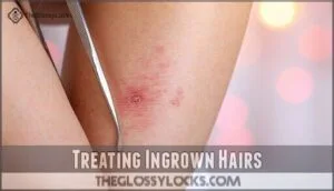 treating ingrown hairs