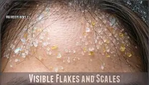 visible flakes and scales