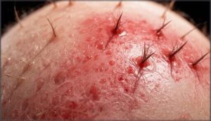 redness and inflammation