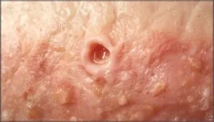 skin conditions that contribute