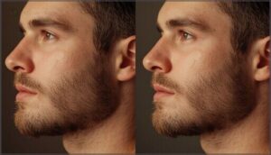 filling in and thicker growth (1-3 months) filling in and thicker growth (1-3 months)