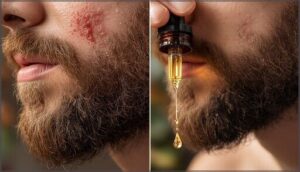 reducing beard itch and dandruff reducing beard itch and dandruff