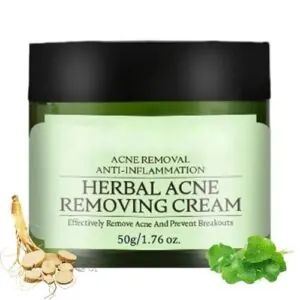 Acne Removing Face Cream, Natural B0FJFMD9JD