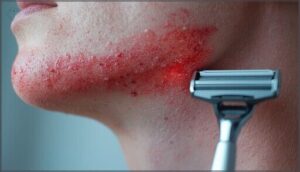 recognizing razor burn symptoms recognizing razor burn symptoms