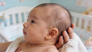 common causes of baby hair loss common causes of baby hair loss