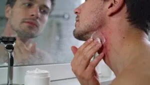 redness, stinging, itching, and mild swelling redness, stinging, itching, and mild swelling