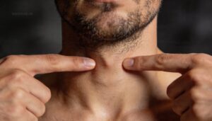 use the two-finger placement method use the two-finger placement method