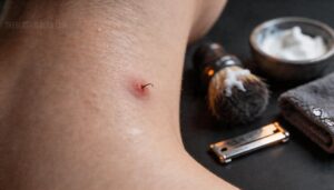 what causes ingrown hairs after shaving what causes ingrown hairs after shaving