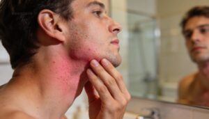 when post-shave redness needs a doctor's attention when post-shave redness needs a doctor's attention