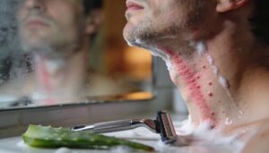 why your skin turns red after shaving why your skin turns red after shaving