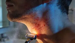 why your skin turns red after shaving why your skin turns red after shaving