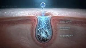 how benzoyl peroxide works how benzoyl peroxide works