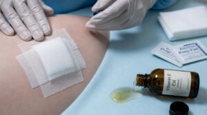 avoid broken surgical wounds avoid broken surgical wounds