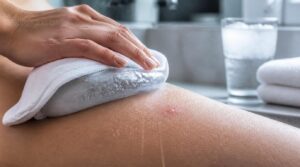 use cold compresses use cold compresses