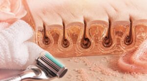 what causes ingrown hairs what causes ingrown hairs