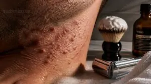 what causes razor bumps what causes razor bumps