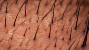 follicles cycle independently follicles cycle independently