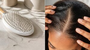 signs hair is growing or shedding signs hair is growing or shedding